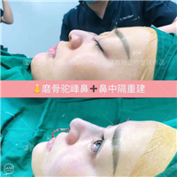 武汉抗衰老整形医生