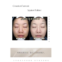 光电项目和注射类，可以当天一起进行吗？