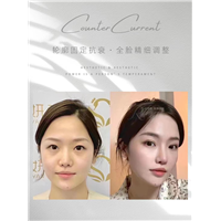 轮廓针多少钱一针
