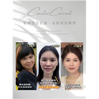 中断嗨体注射颈纹后，颈纹会不会重新出现？