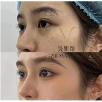 广州轻医美