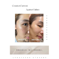 怎样增加脸部胶原蛋白