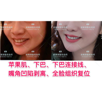 北京剥离微整地址