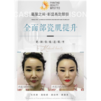 全棉布瓷肌提升