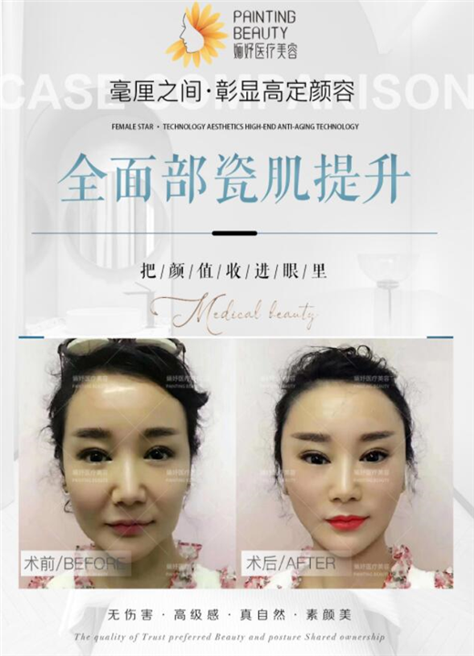 全棉布瓷肌提升