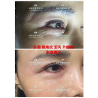 剥离印第安纹多少钱