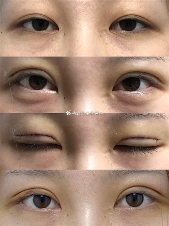 李树平