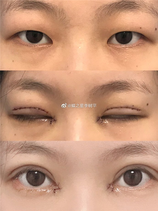 李树平