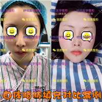 成都妤悦整形|妤悦医疗美容