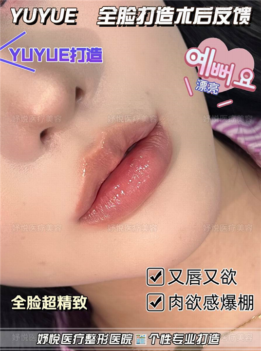 妤悦整形鼻综合