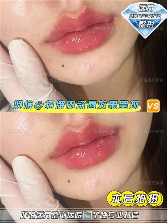 成都妤悦整形医院
