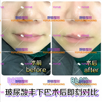 成都鼻综合整形|成都眼综合整形