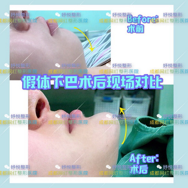 妤悦医疗美容|成都网红整形