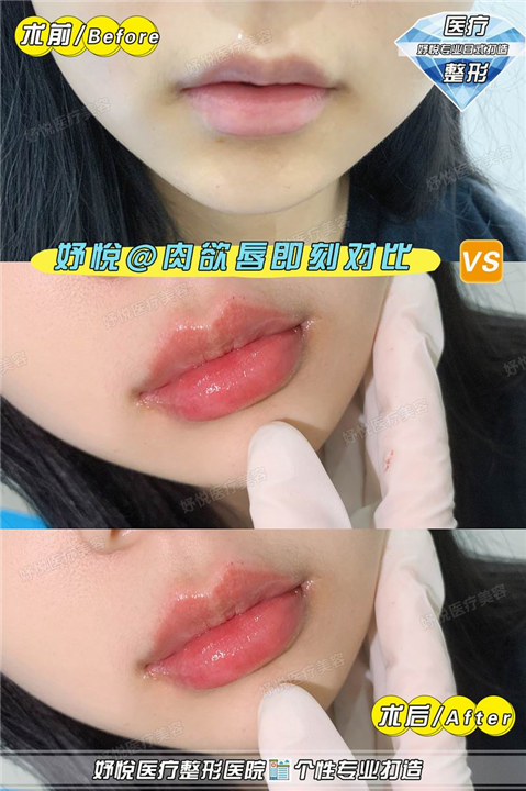 妤悦医疗美容医院