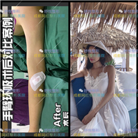 妤悦整形吸脂瘦身