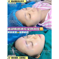 妤悦整形鼻综合