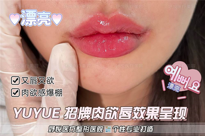 成都妤悦整形医院