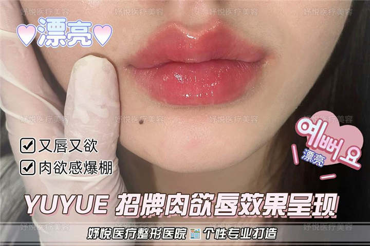 成都妤悦整形医院
