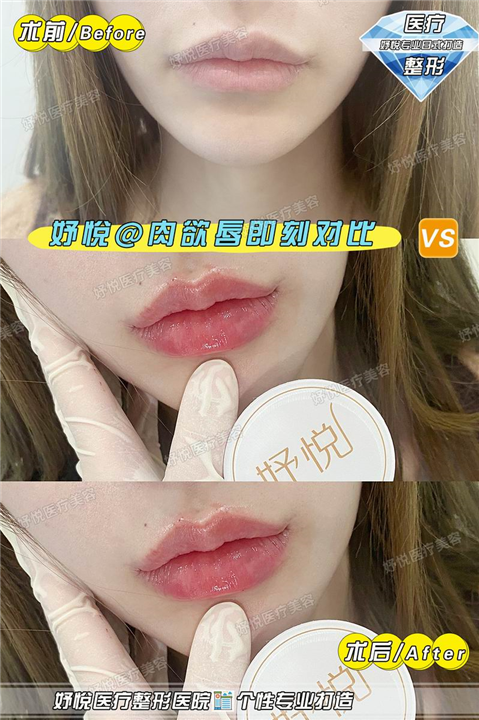 妤悦医疗美容