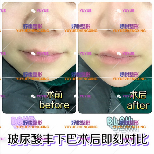 成都鼻综合整形|成都眼综合整形
