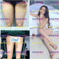 妤悦整形吸脂瘦身