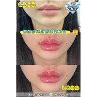 妤悦整形鼻综合