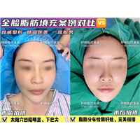妤悦整形鼻综合