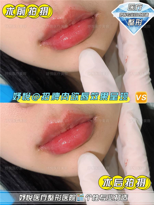 妤悦医疗美容医院
