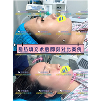 成都妤悦整形|妤悦医疗美容