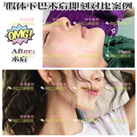 成都网红整形|成都鼻综合整形