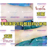 妤悦整形吸脂瘦身