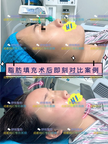 成都妤悦整形|妤悦医疗美容