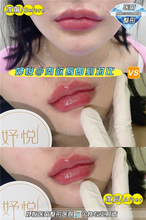 妤悦医疗美容医院