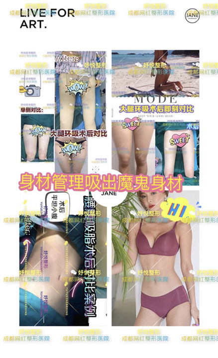 妤悦整形吸脂瘦身