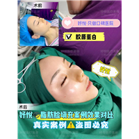 妤悦整形鼻综合