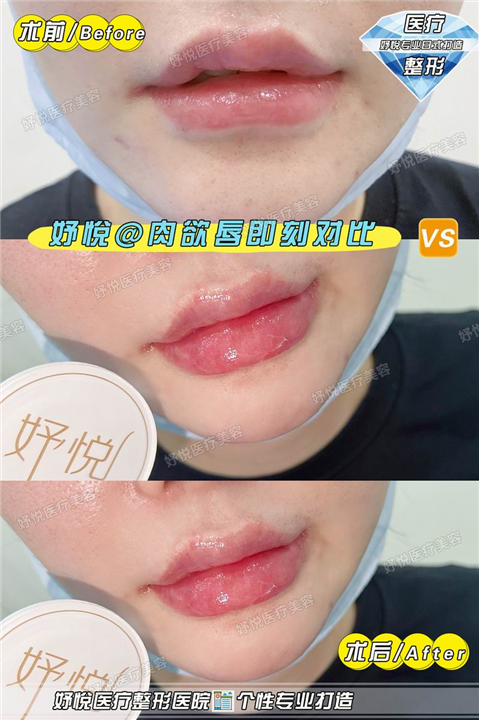 妤悦医疗美容