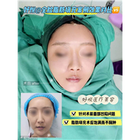 妤悦整形鼻综合