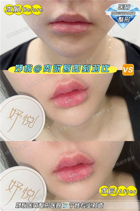 妤悦医疗美容