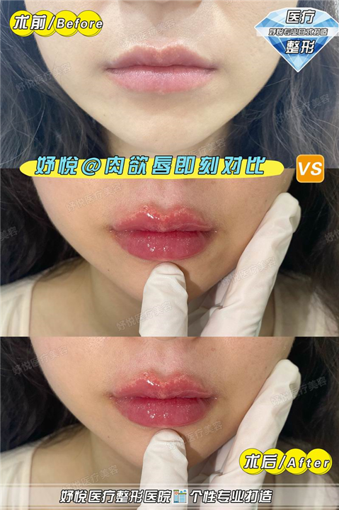 成都妤悦整形医院