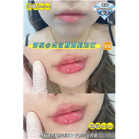 妤悦整形鼻综合