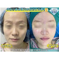 妤悦整形眼综合