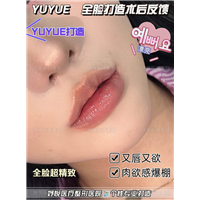 妤悦整形鼻综合