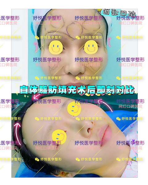 成都妤悦整形|妤悦医疗美容