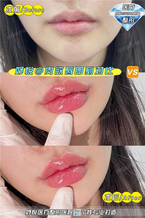 成都妤悦整形医院