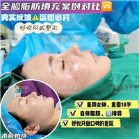 妤悦整形鼻综合