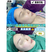 妤悦整形眼综合