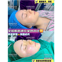 妤悦整形鼻综合