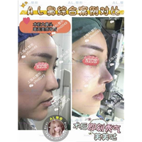 上海AL全脸打造|上海AL怎么样