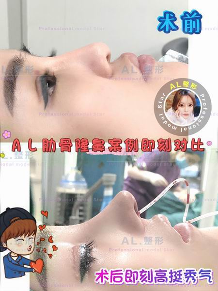 上海AL全脸打造|上海AL怎么样