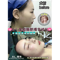 上海AL鼻综合|上海AL眼综合